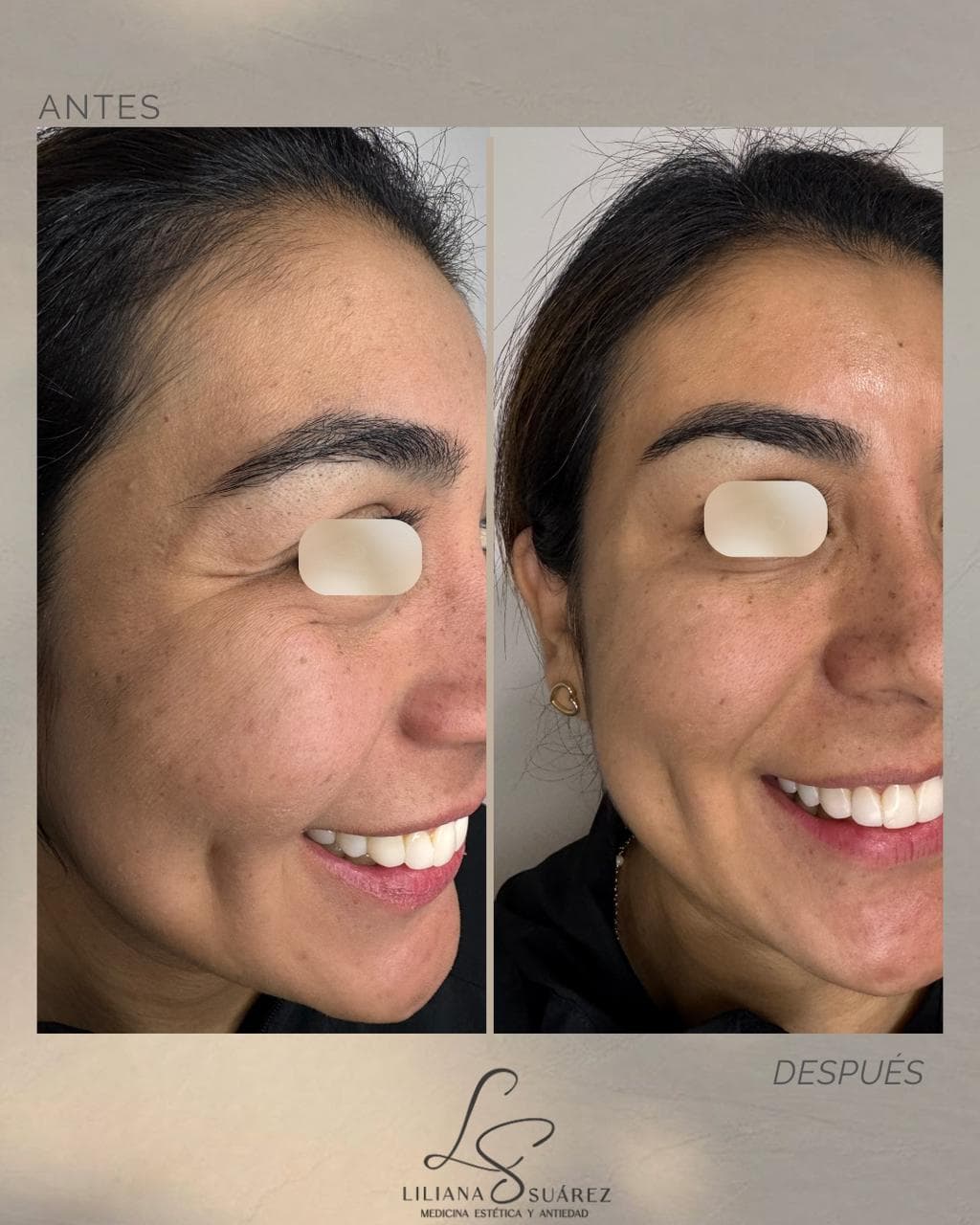 Skincare: Rutina Diaria para una Piel Radiante